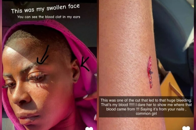 Khloe Breaks Her Silence: “I Was Attacked Not the Attacker”