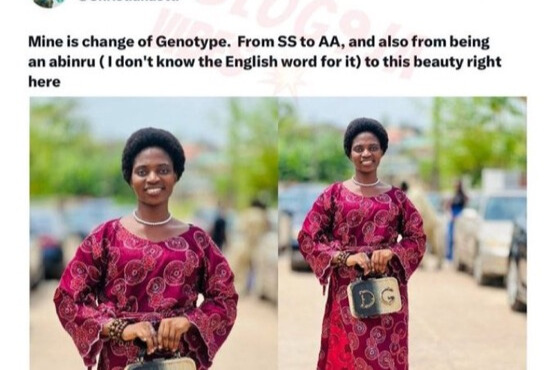 X User Claims God Changed Her Genotype but Old Post Tells a Different Story