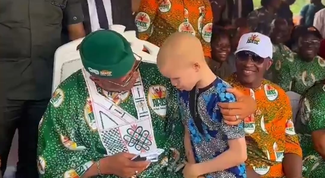 Akwa Ibom Governor Umo Eno Speaks on Growing Up with Albinism, Vows to Honour Others with the Condition